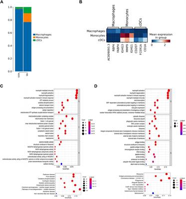 Single-cell RNA sequencing reveals distinct tumor microenvironment of ground glass nodules and solid nodules in lung adenocarcinoma